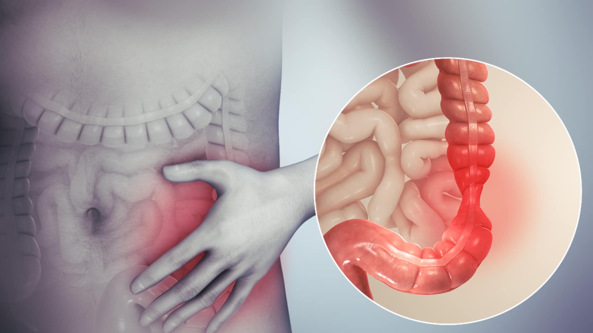 Changes in Bowel Habits