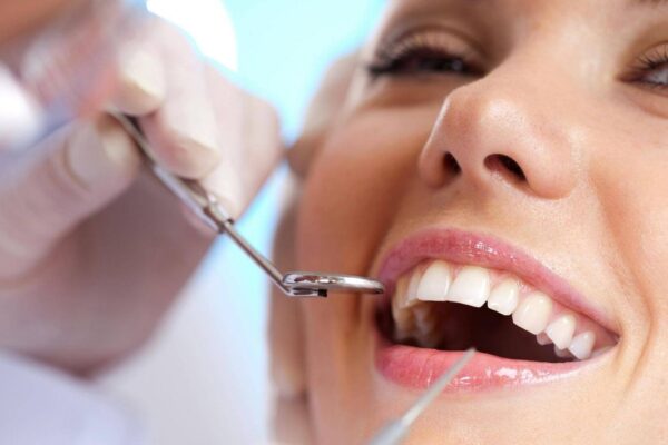 How to Clean your Dental Implants Properly