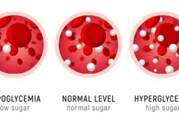 Difference Between Hypoglycemia and Hyperglycemia