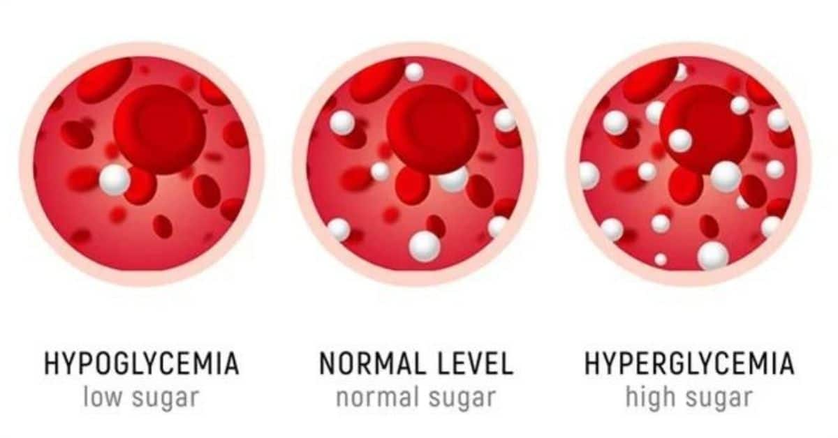 Difference Between Hypoglycemia and Hyperglycemia
