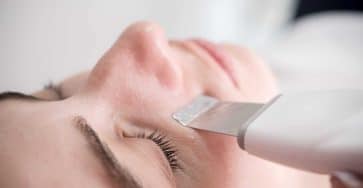 Microdermabrasion