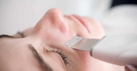 Microdermabrasion