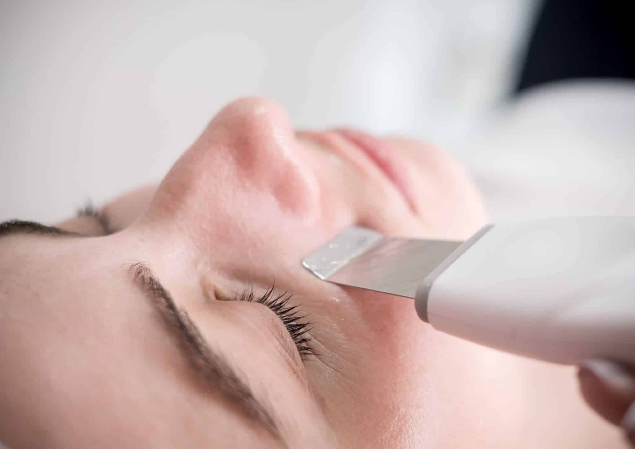 Microdermabrasion