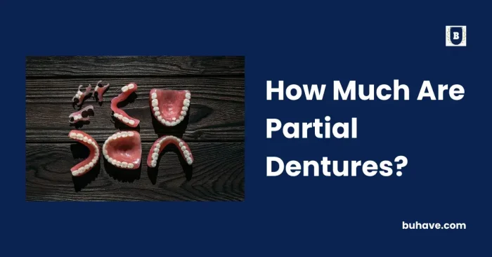 How Much Are Partial Dentures