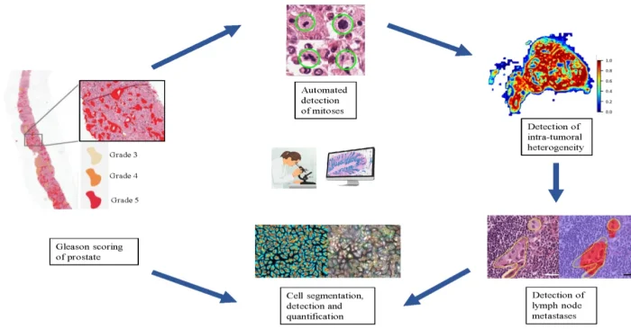 AI tools for pathology analysis