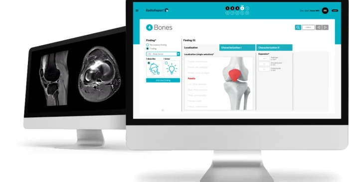 AI tools for radiology reports
